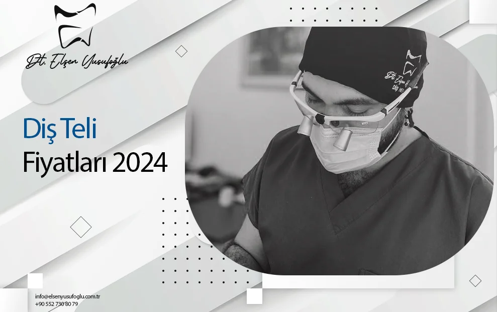 Diş Teli Fiyatları 2024