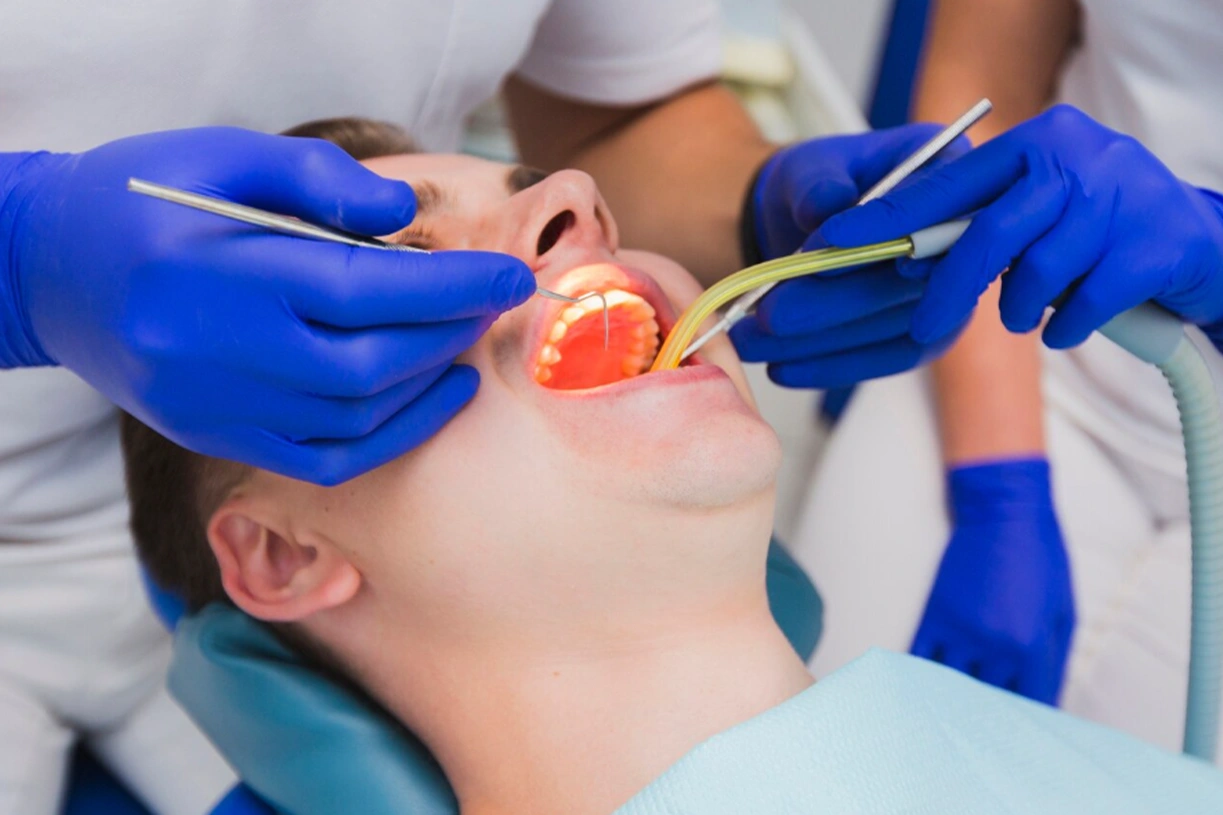 Root Canal Treatment Fees in Ankara
