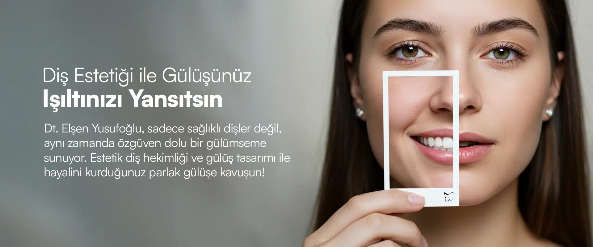 Diş Estetiği Ankara