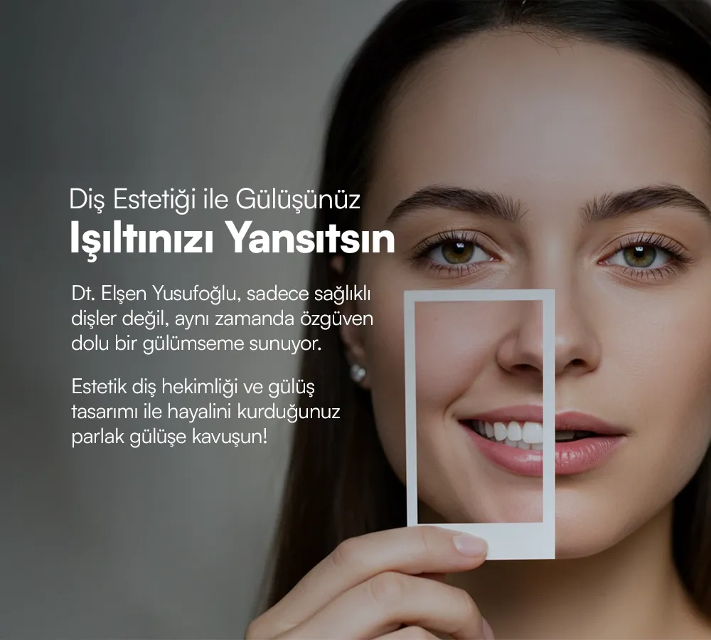 Diş Estetiği Ankara